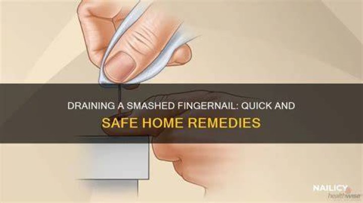 How to drain a smashed finger?